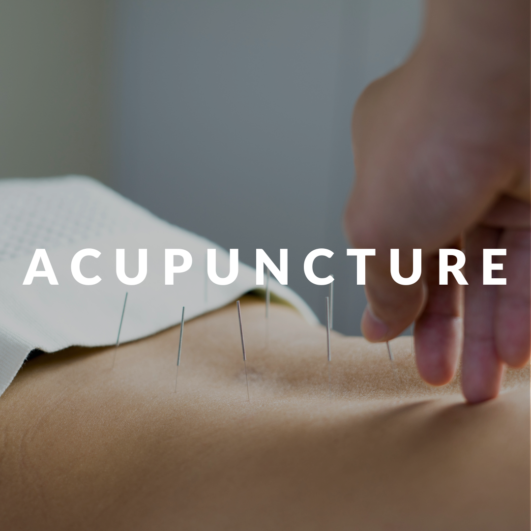 acupuncture